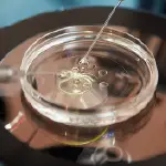 ICSI - Intra Cytoplasmic Sperm Injection